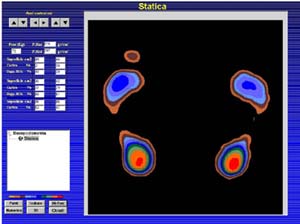 bpe statica hd